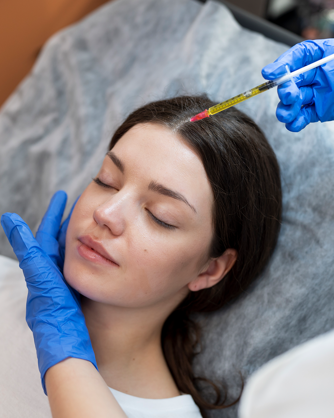 i-PRF hair restoration patient at GlowMedix Clinic