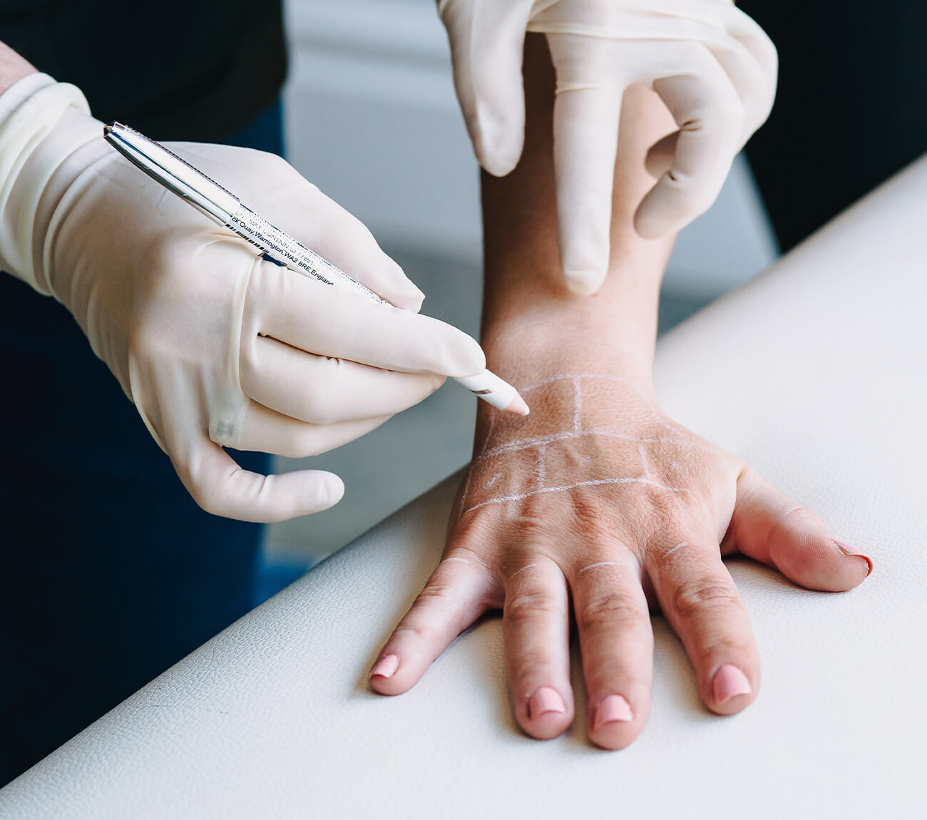 Hand rejuvenation and skin booster treatment at GlowMedix Clinic London