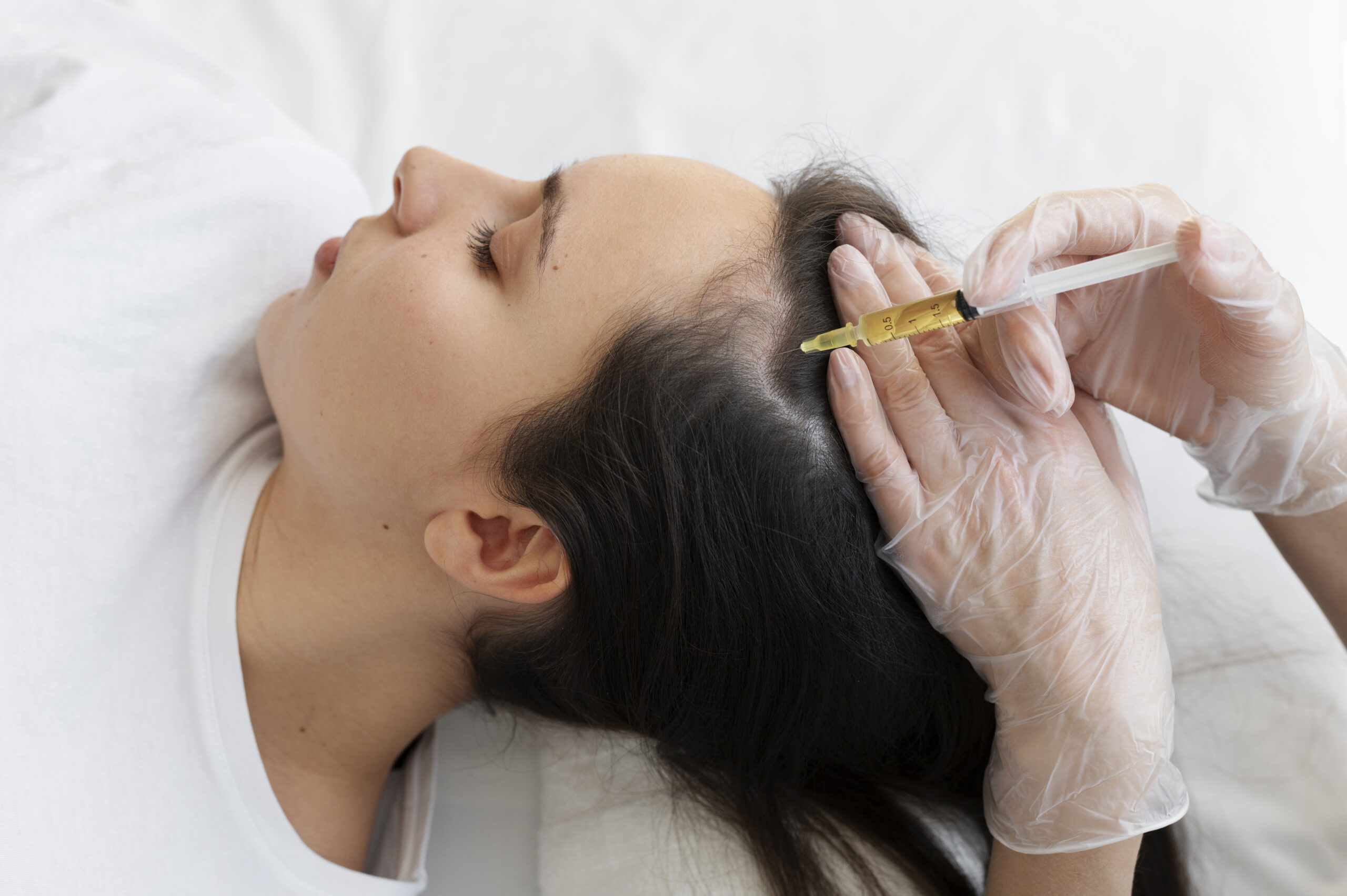 Female patient receiving hair exosome scalp treatment at GlowMedix Clinic