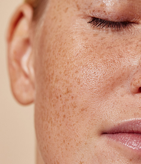 Skin Tox treatment protocol at GlowMedix Clinic London
